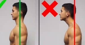 Forward head posture